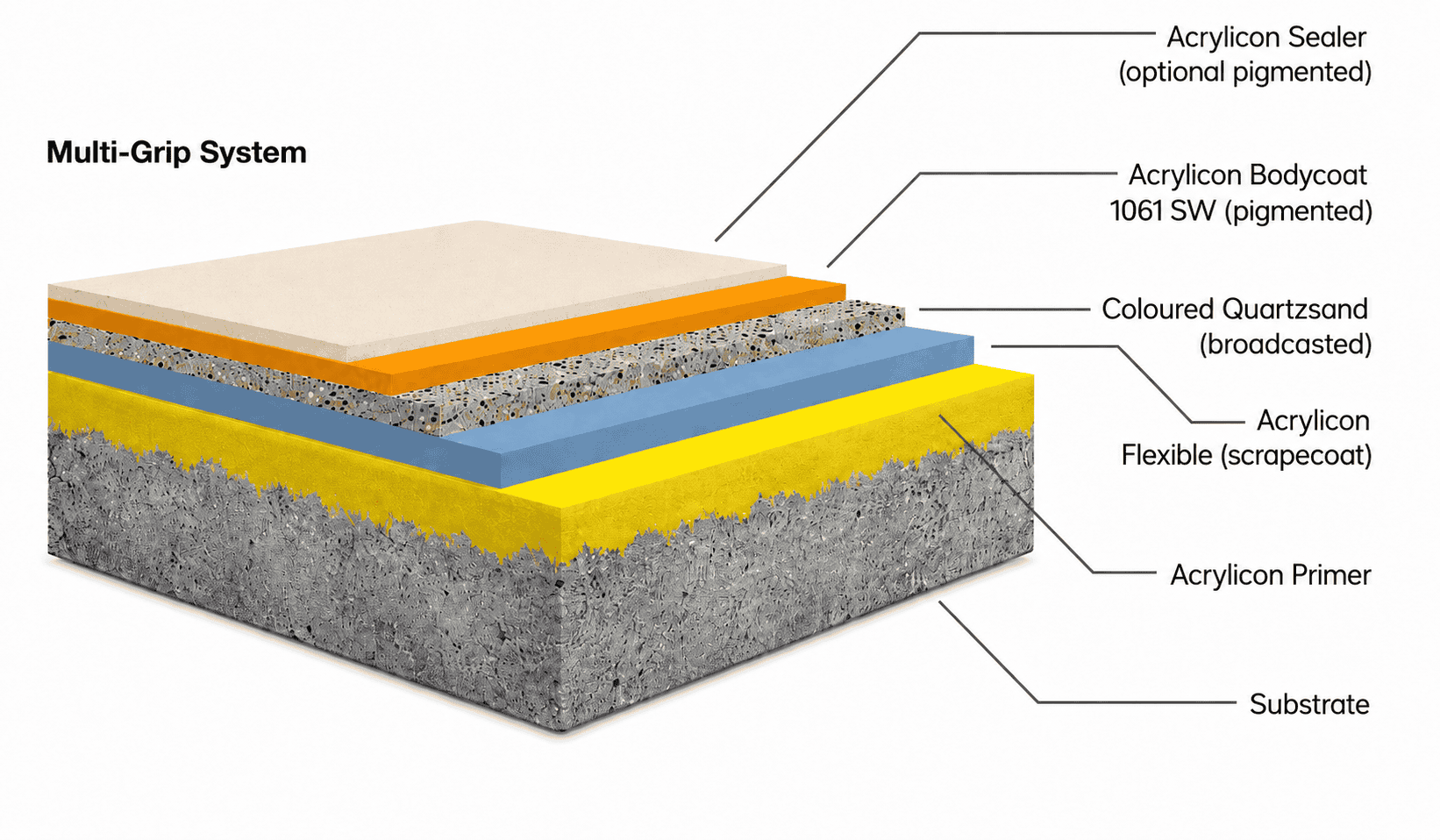 Systemaufbau des AcryliCon Multi-Grip Systems